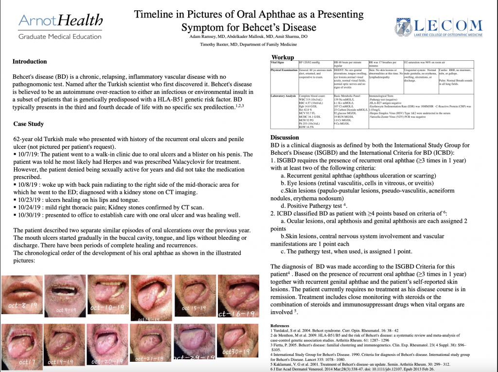 Edition 67 –Timeline in Pictures of Oral Aphthae as a Presenting Symptom for Behcet’s Disease
